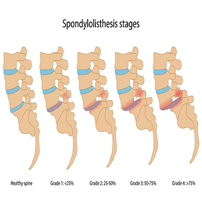 Spine Stretch Machine