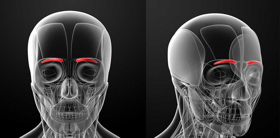 Muscles in the eyebrows responsible for headaches